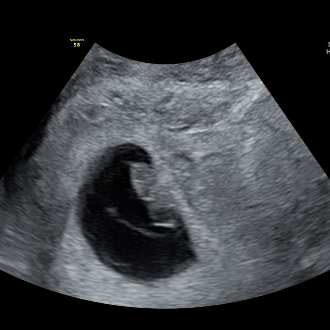 Photo shared by Hannah for their Babylist baby registry.