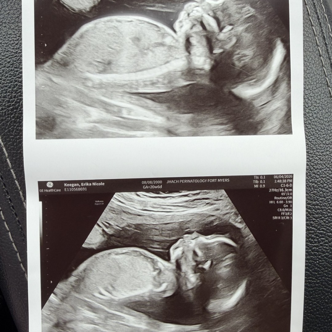 Photo shared by Erika for their Babylist baby registry.