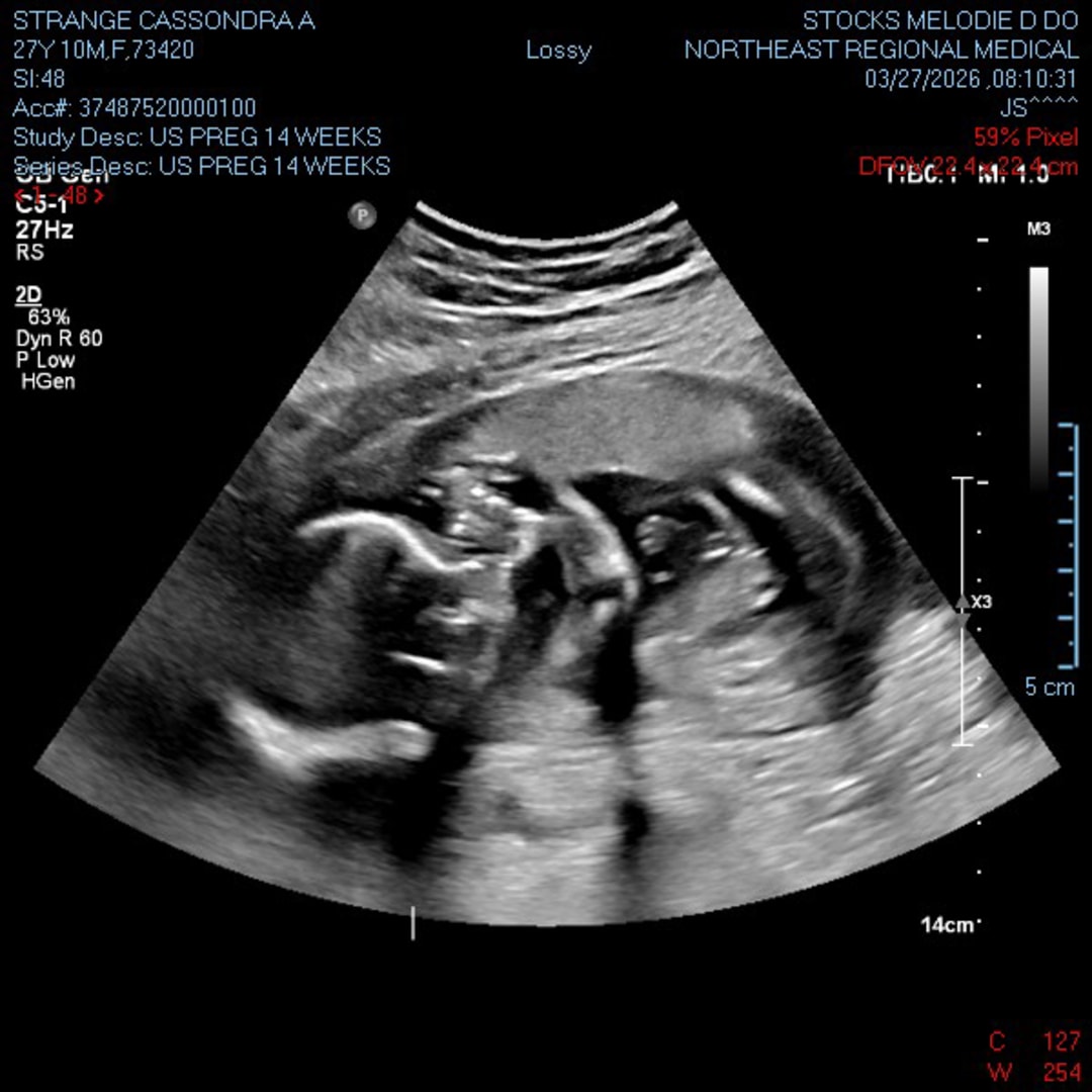 Photo shared by Cassie for their Babylist baby registry.