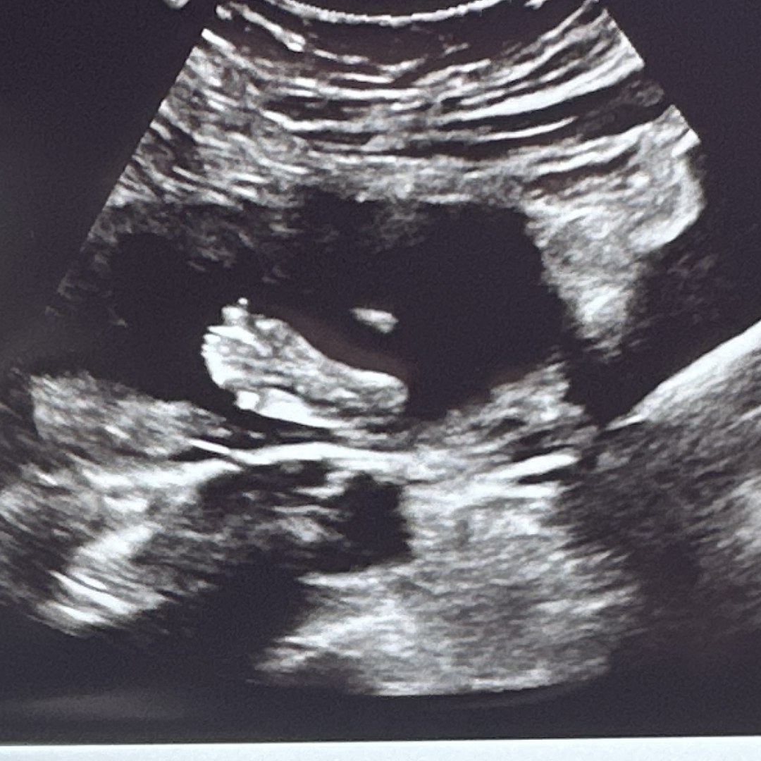 Photo shared by Jillian for their Babylist baby registry.