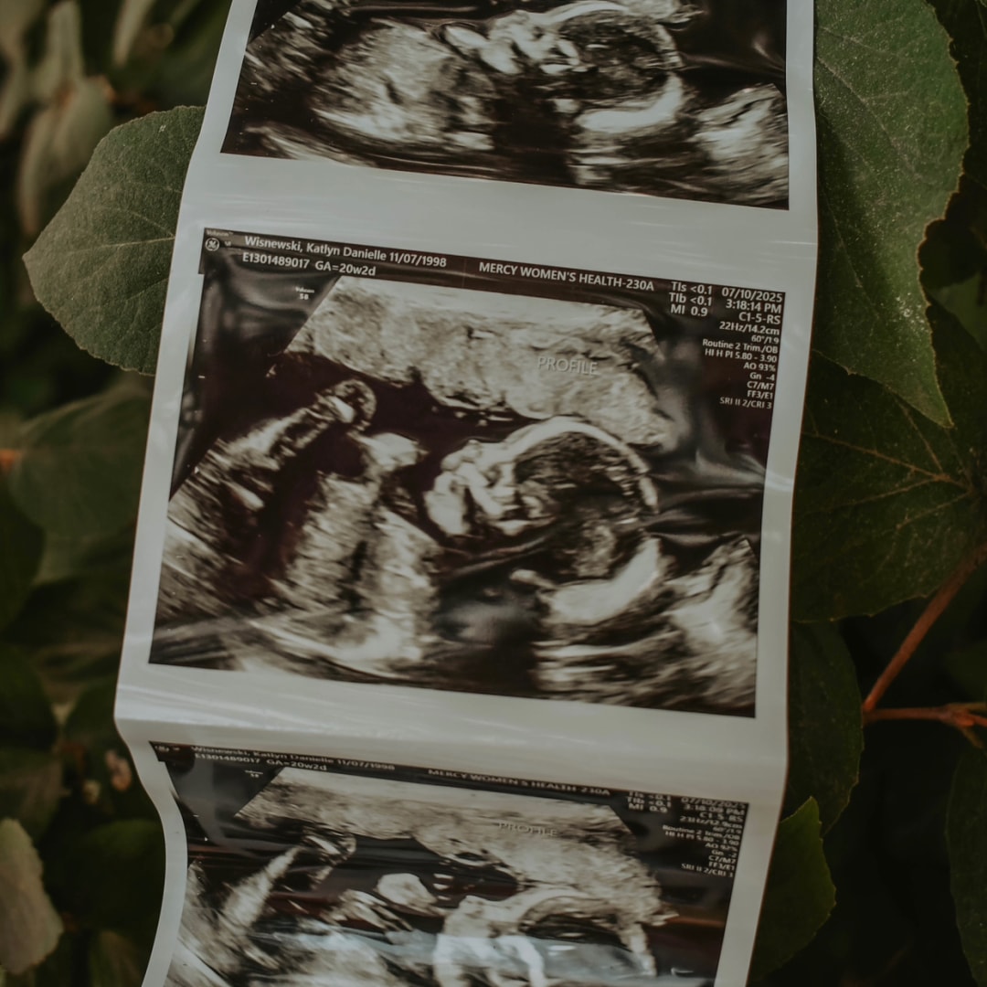Photo shared by Katlyn for their Babylist baby registry.