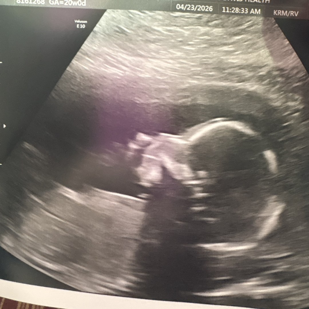 Photo shared by Haylee for their Babylist baby registry.