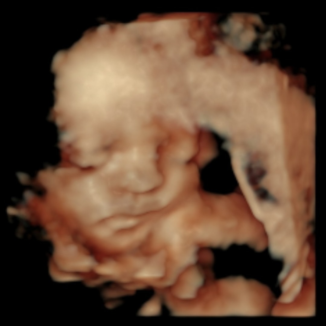 Photo shared by Maria for their Babylist baby registry.