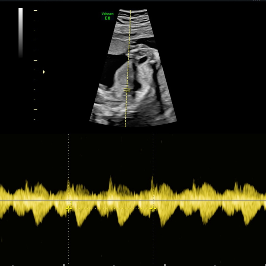 Photo shared by Kala for their Babylist baby registry.