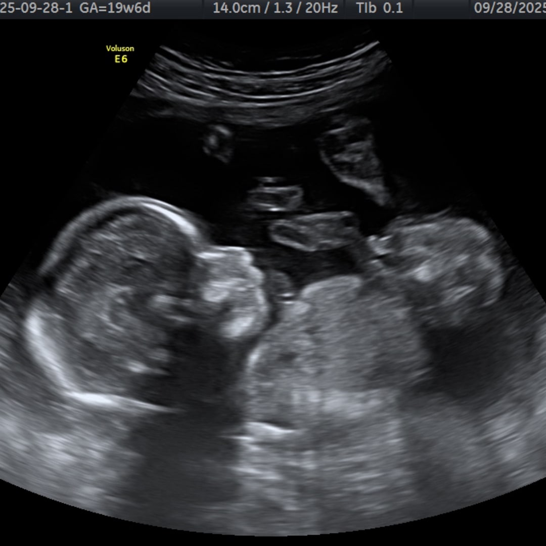 Photo shared by Ryan for their Babylist baby registry.