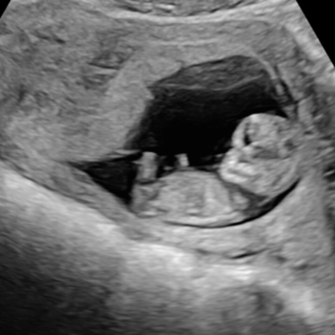 Photo shared by Mary for their Babylist baby registry.