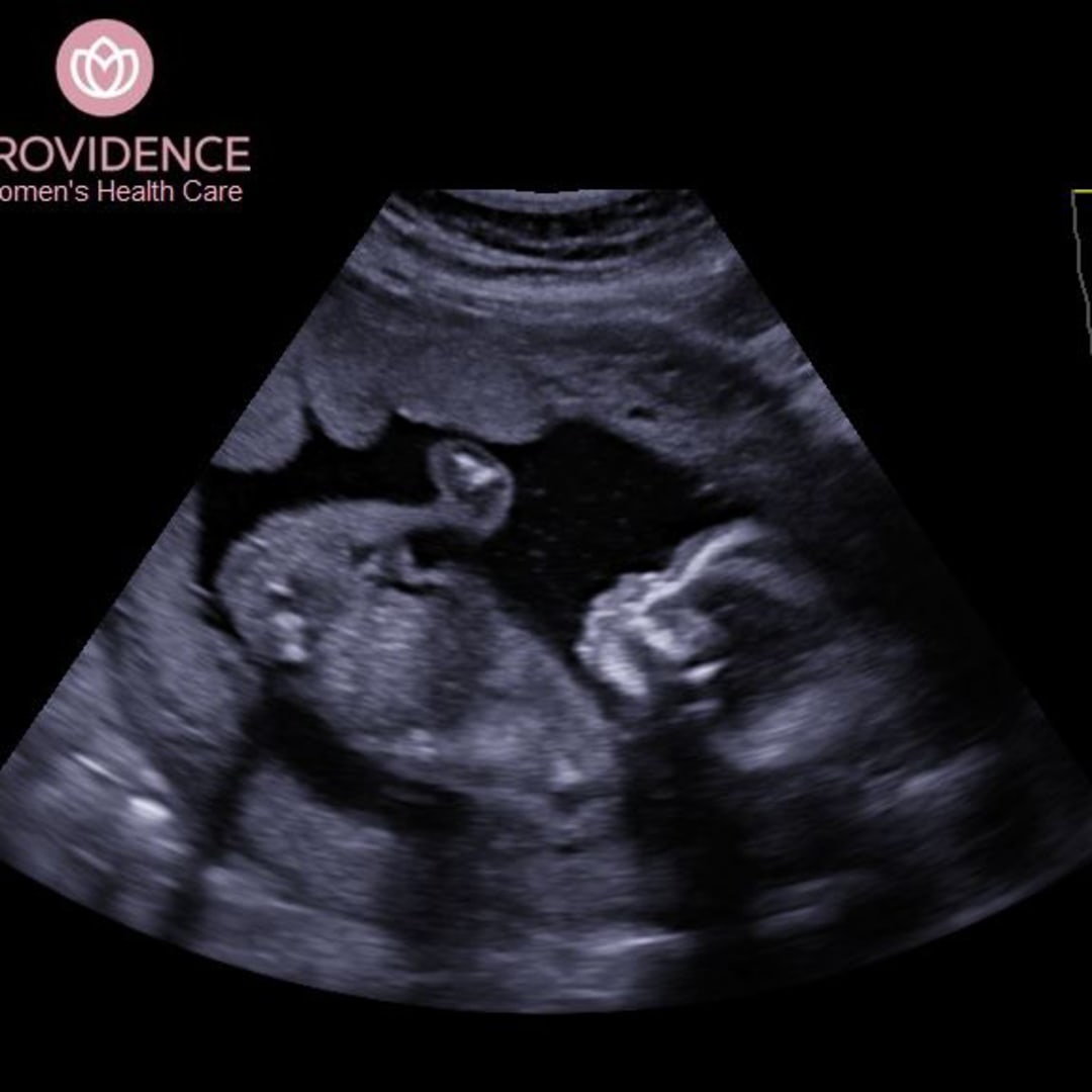 Photo shared by Jessica for their Babylist baby registry.
