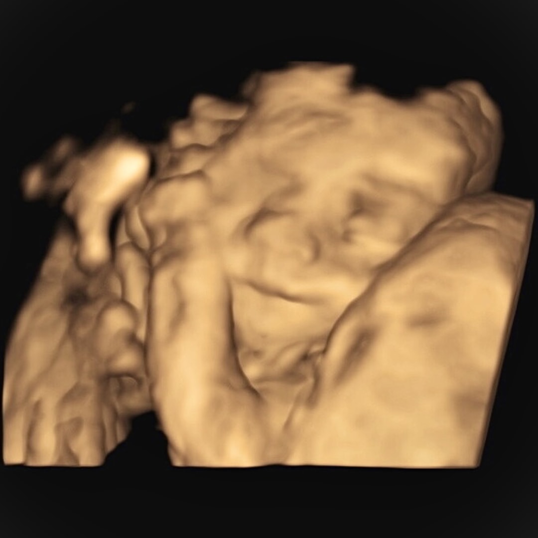 Photo shared by Ashley for their Babylist baby registry.