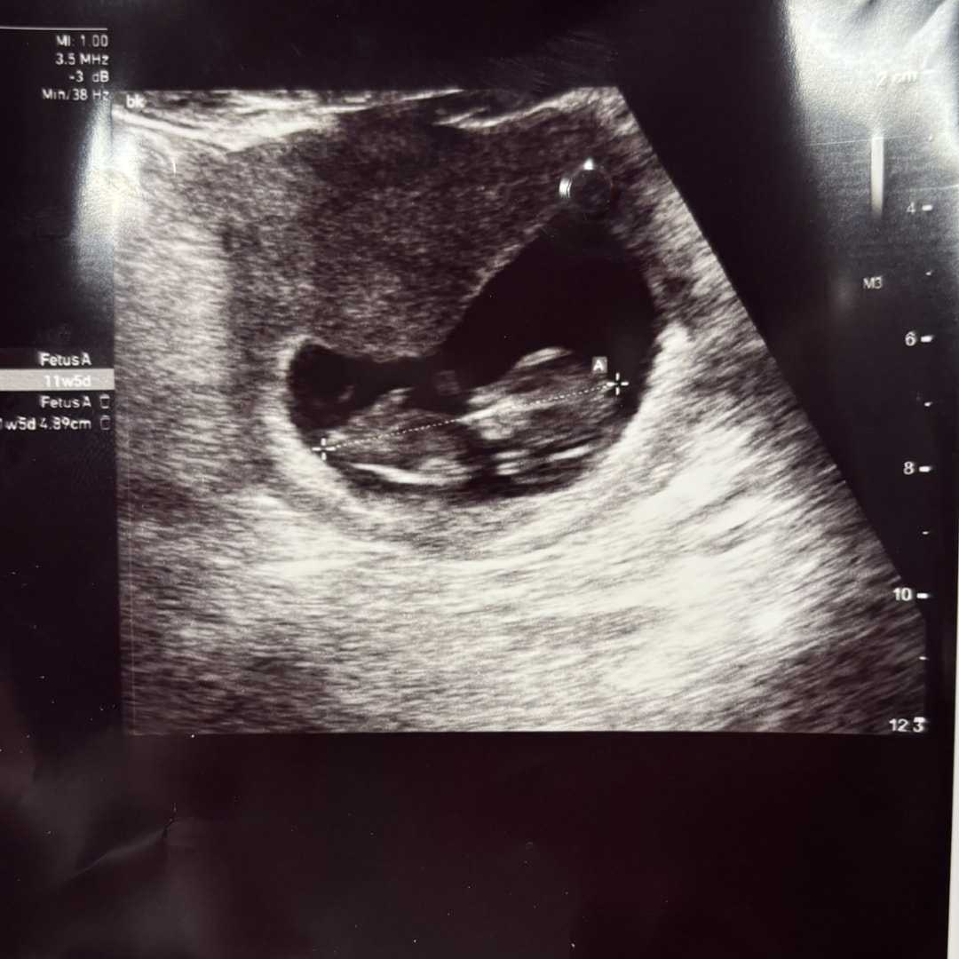 Photo shared by Taylor for their Babylist baby registry.