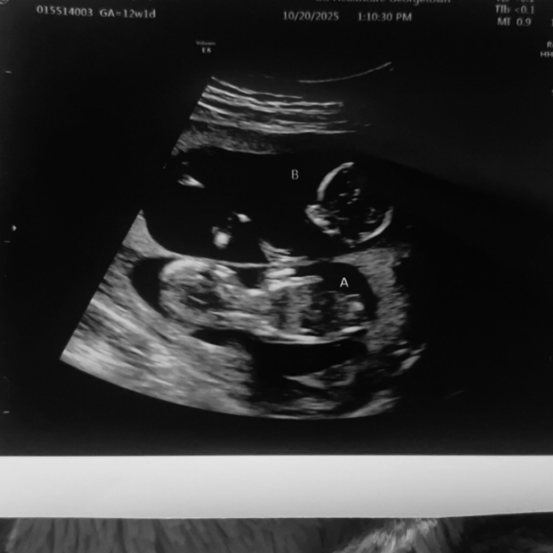 Photo shared by Isabel for their Babylist baby registry.