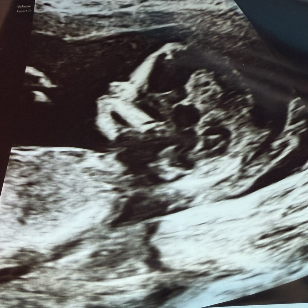 Photo shared by Ashley for their Babylist baby registry.