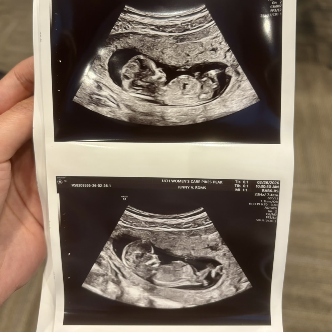 Photo shared by Eden for their Babylist baby registry.