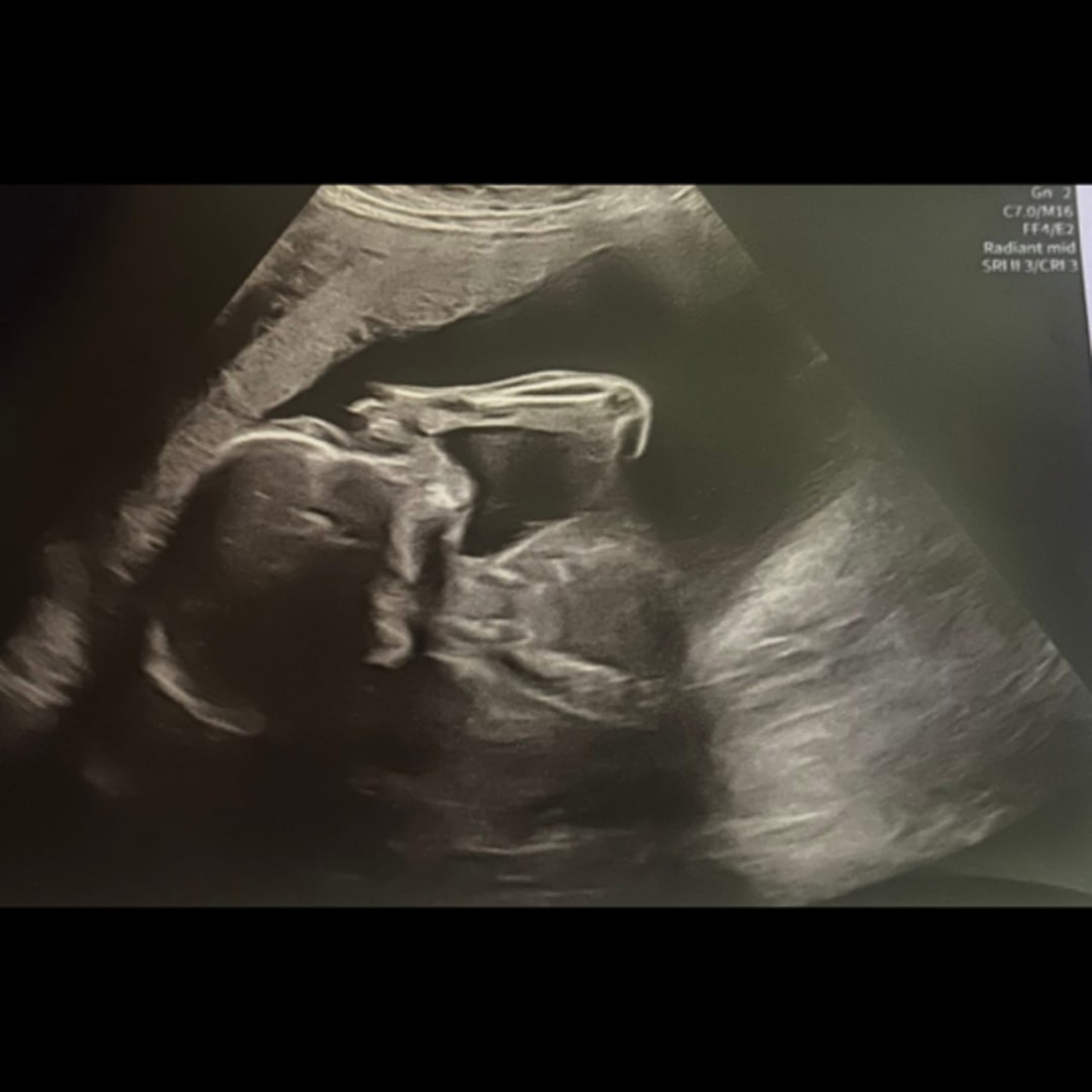 Photo shared by Amy for their Babylist baby registry.