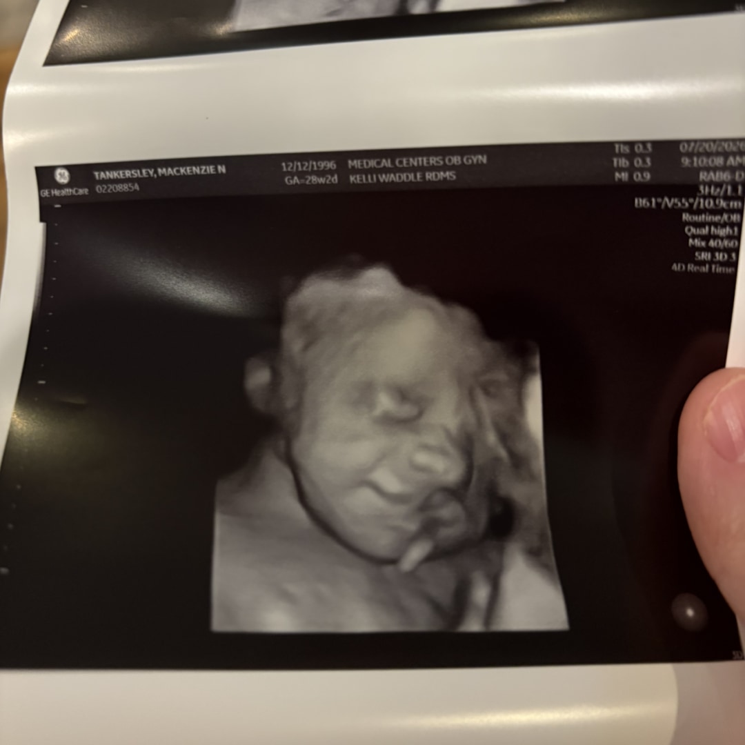 Photo shared by Mackenzie for their Babylist baby registry.