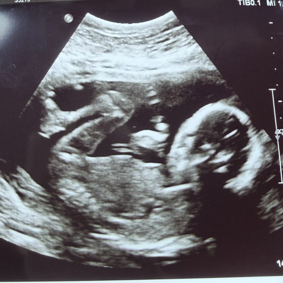 Photo shared by Brittany for their Babylist baby registry.