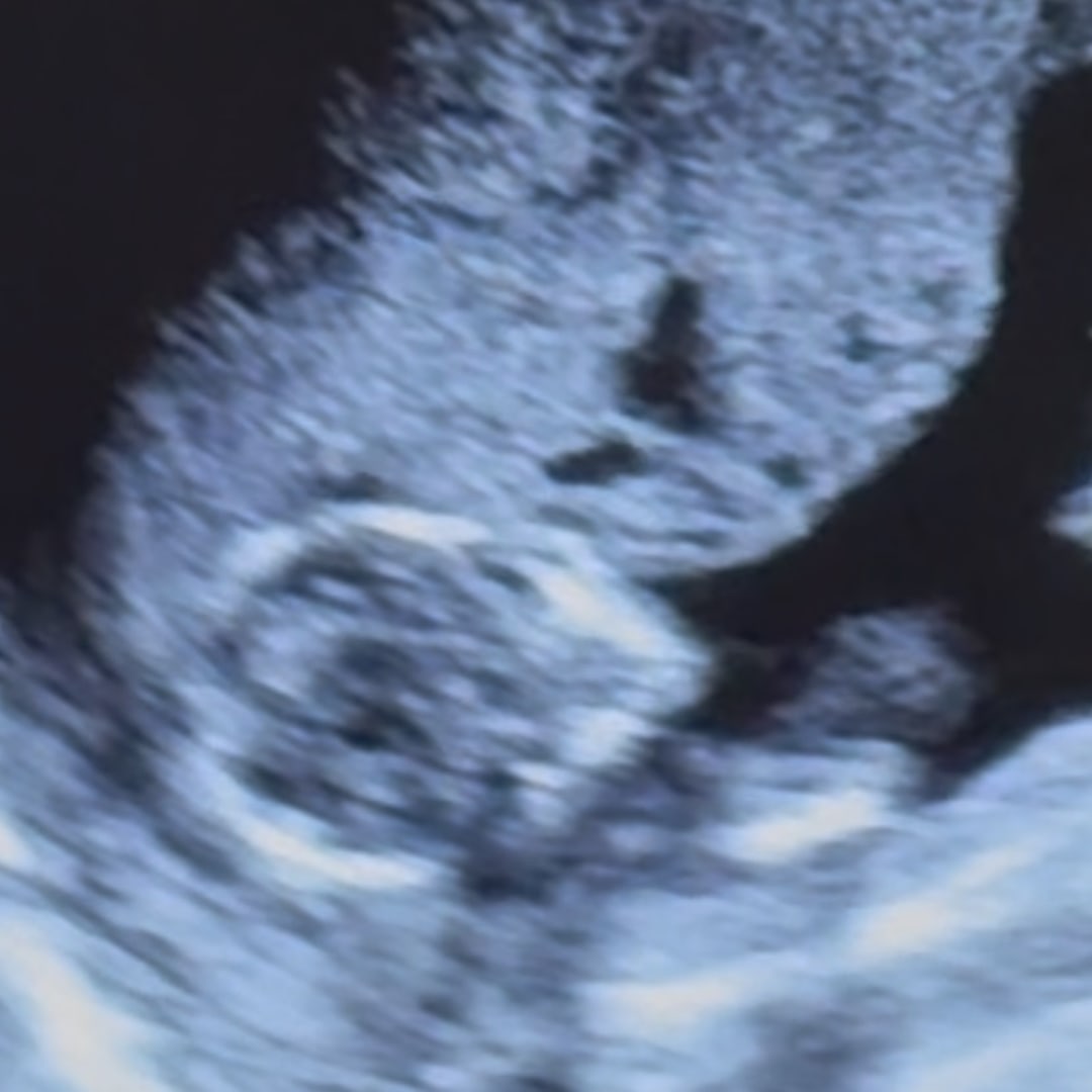 Photo shared by Mary for their Babylist baby registry.