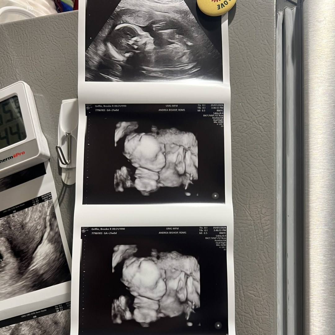 Photo shared by Brooke for their Babylist baby registry.