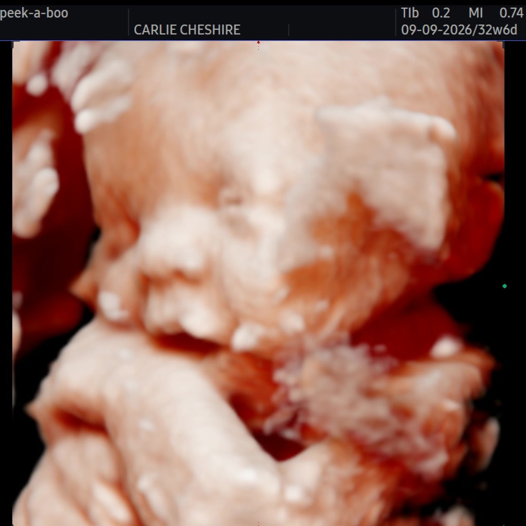 Photo shared by Carlie for their Babylist baby registry.