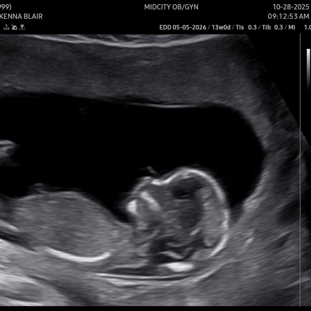 Photo shared by McKenna for their Babylist baby registry.