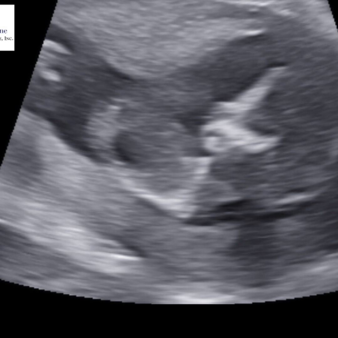 Photo shared by Cydney for their Babylist baby registry.