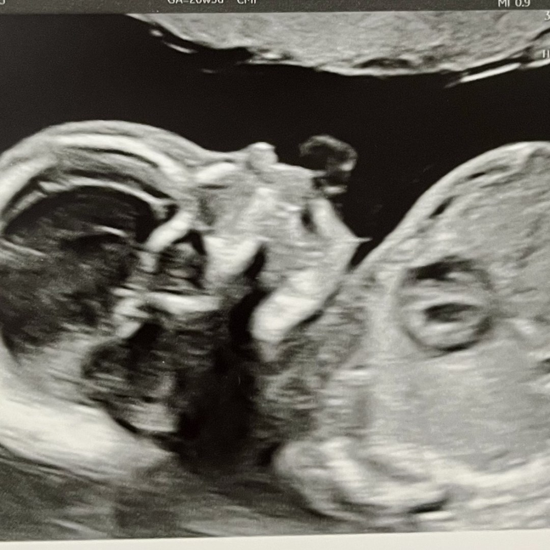 Photo shared by Amanda for their Babylist baby registry.