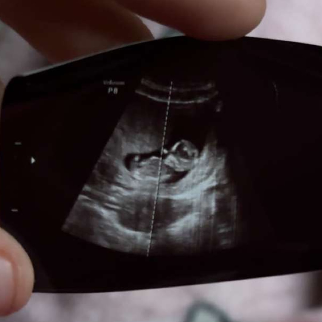 Photo shared by Allison for their Babylist baby registry.