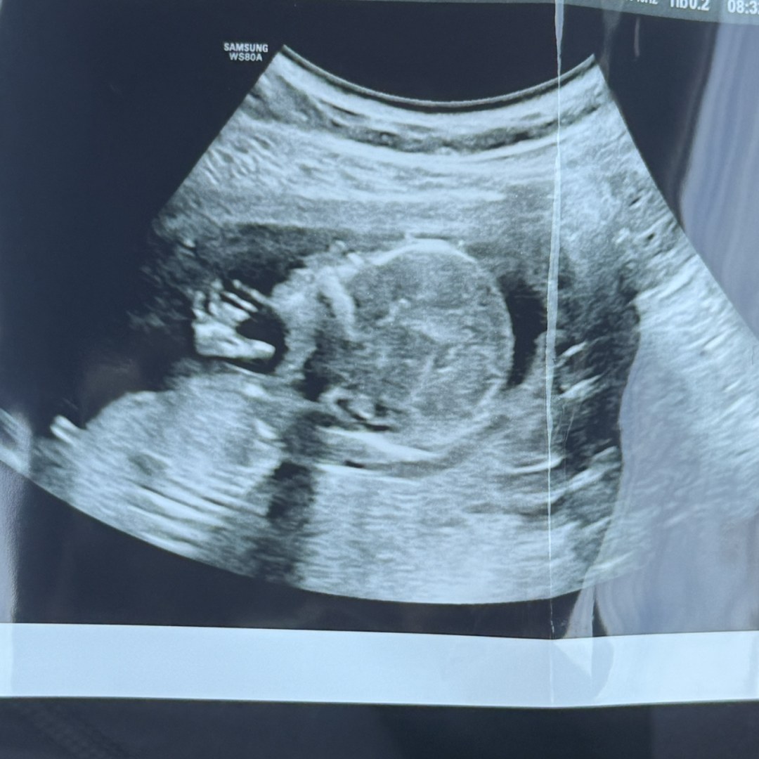 Photo shared by Taylor for their Babylist baby registry.