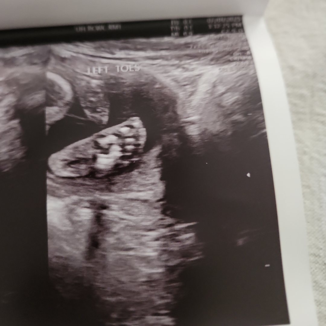 Photo shared by Emily for their Babylist baby registry.