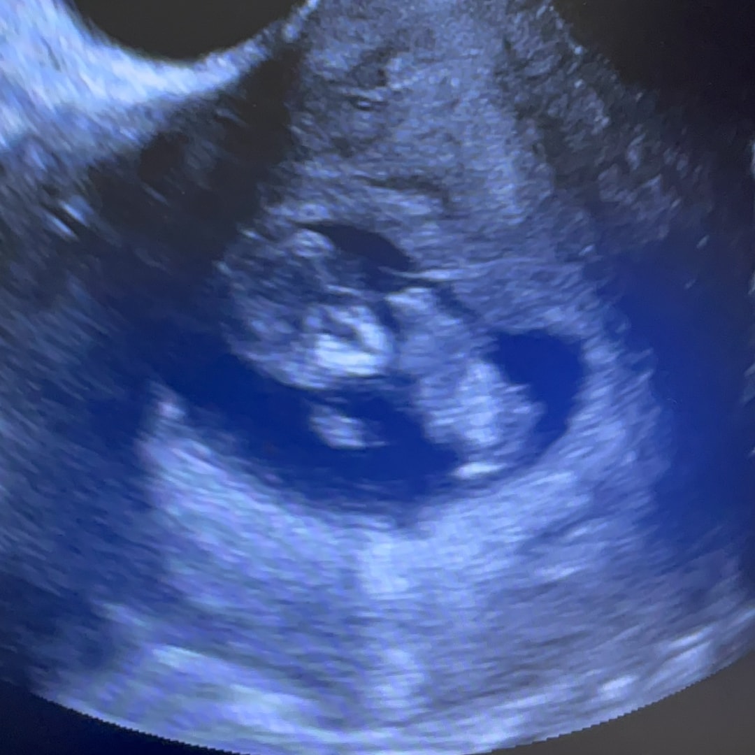 Photo shared by Camille for their Babylist baby registry.