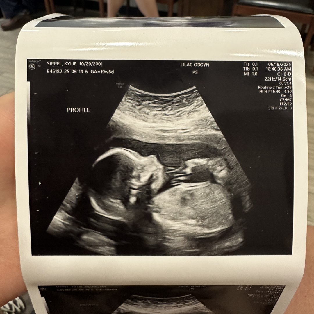 Photo shared by Kylie for their Babylist baby registry.