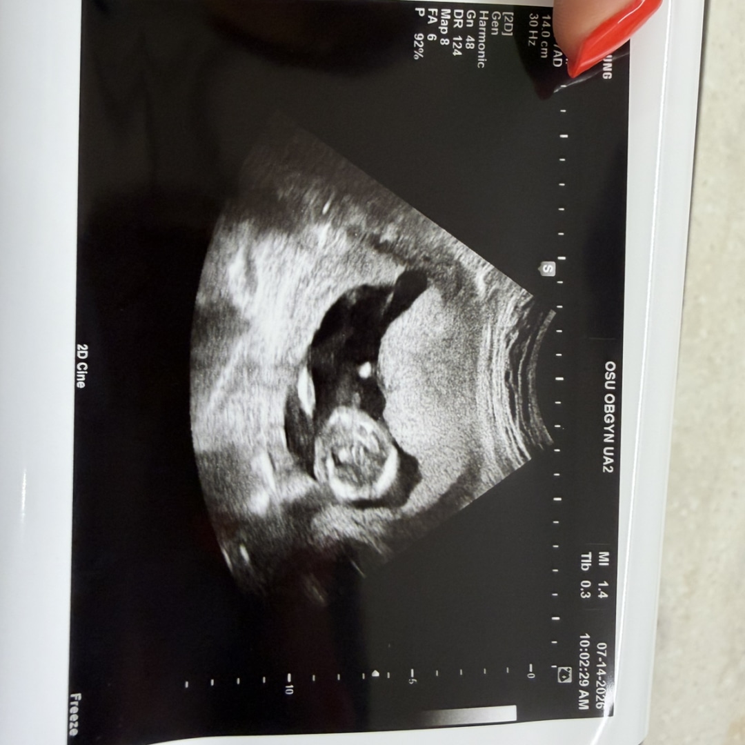 Photo shared by Alexandria for their Babylist baby registry.