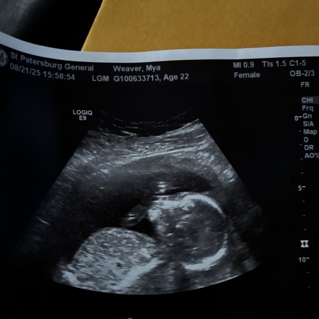 Photo shared by Mya for their Babylist baby registry.