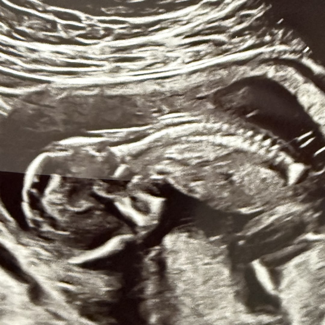 Photo shared by Piney & Andrew for their Babylist baby registry.