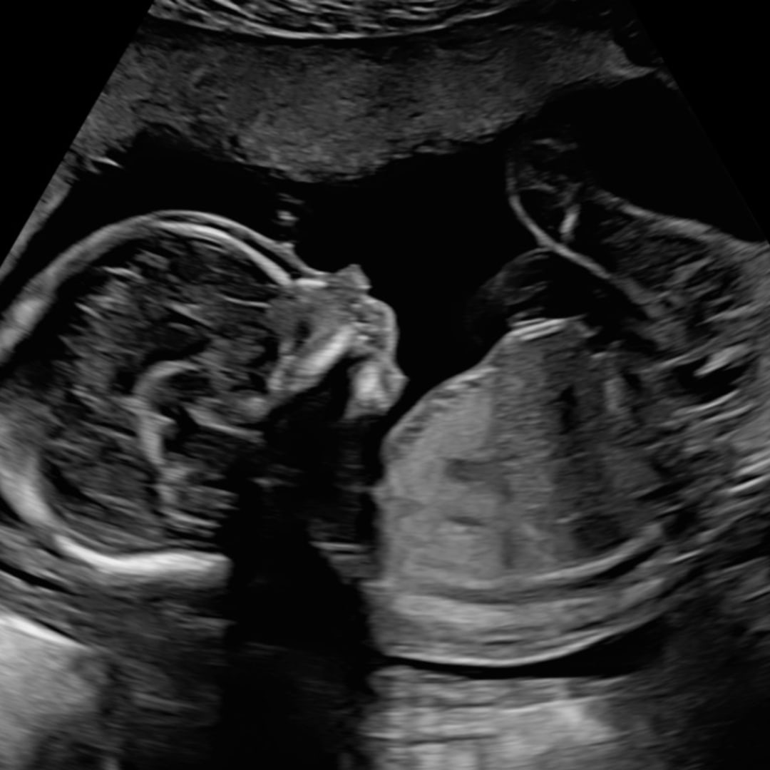 Photo shared by Ellen for their Babylist baby registry.