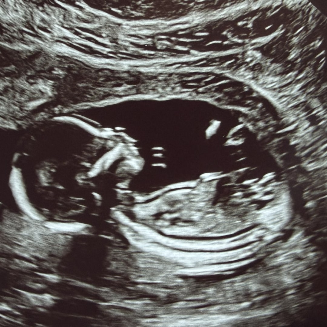 Photo shared by Marilyn and Patrick for their Babylist baby registry.