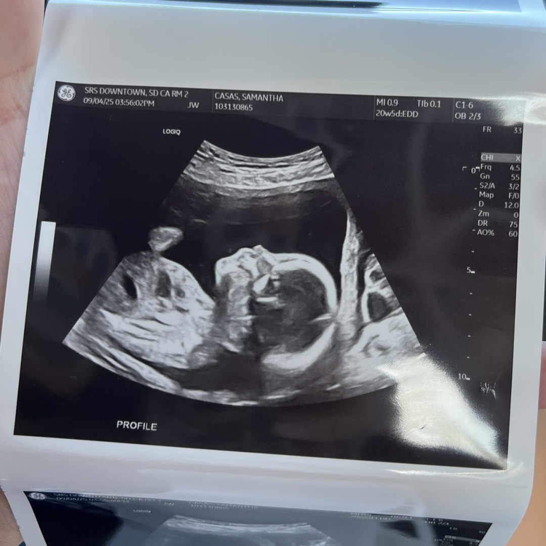 Photo shared by Sam for their Babylist baby registry.