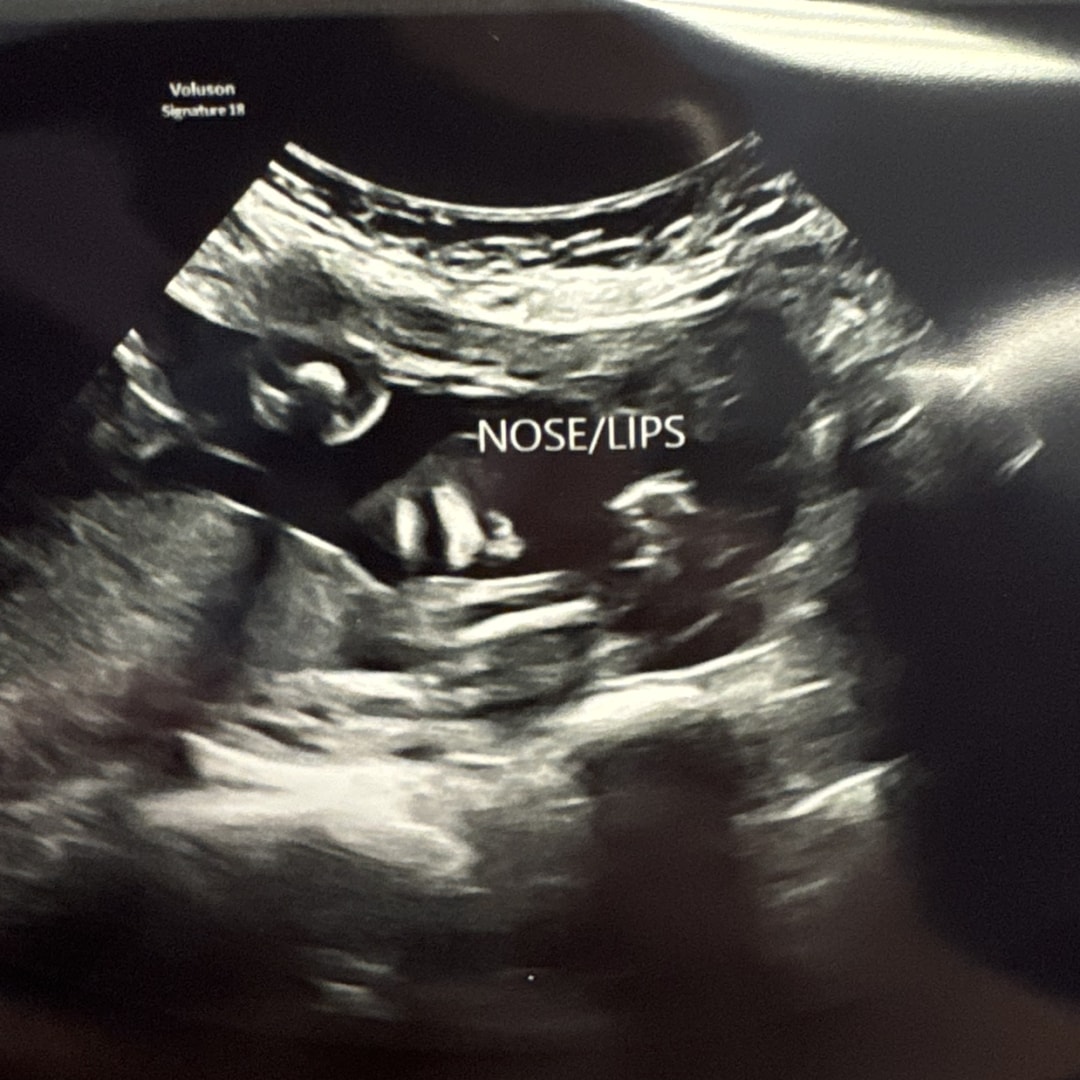 Photo shared by Nea for their Babylist baby registry.