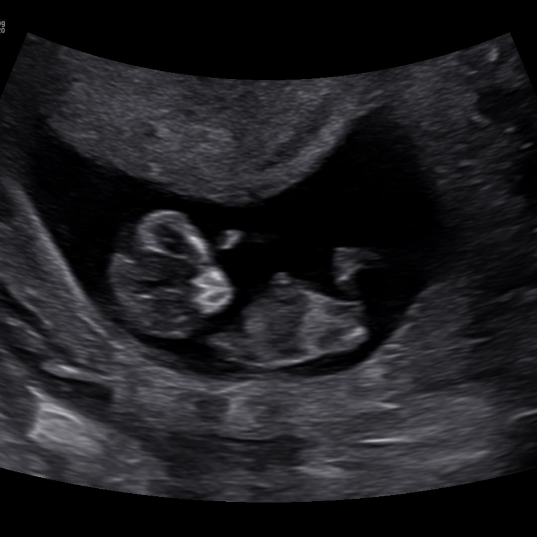Photo shared by Allie for their Babylist baby registry.