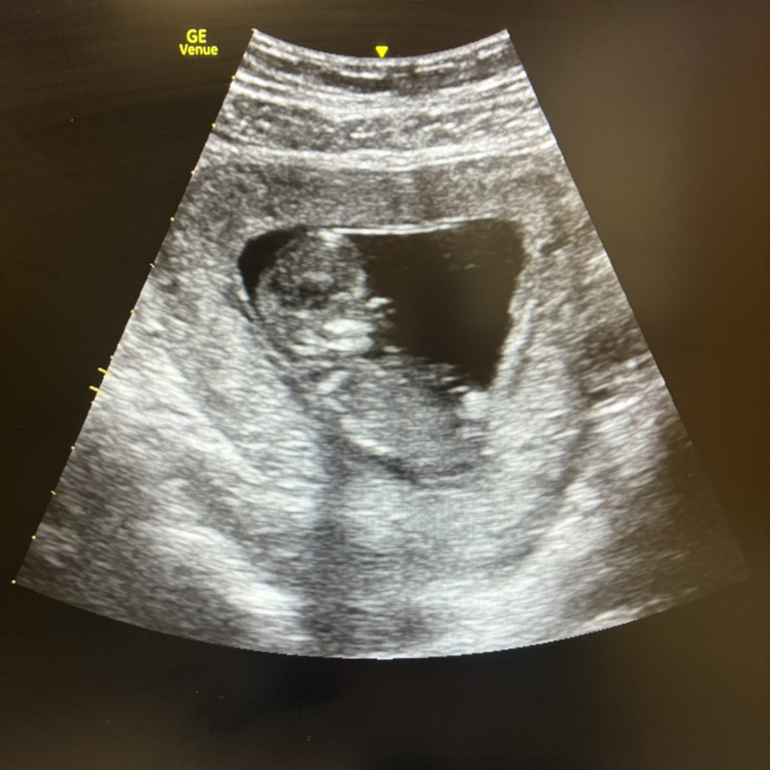 Photo shared by Chloe for their Babylist baby registry.