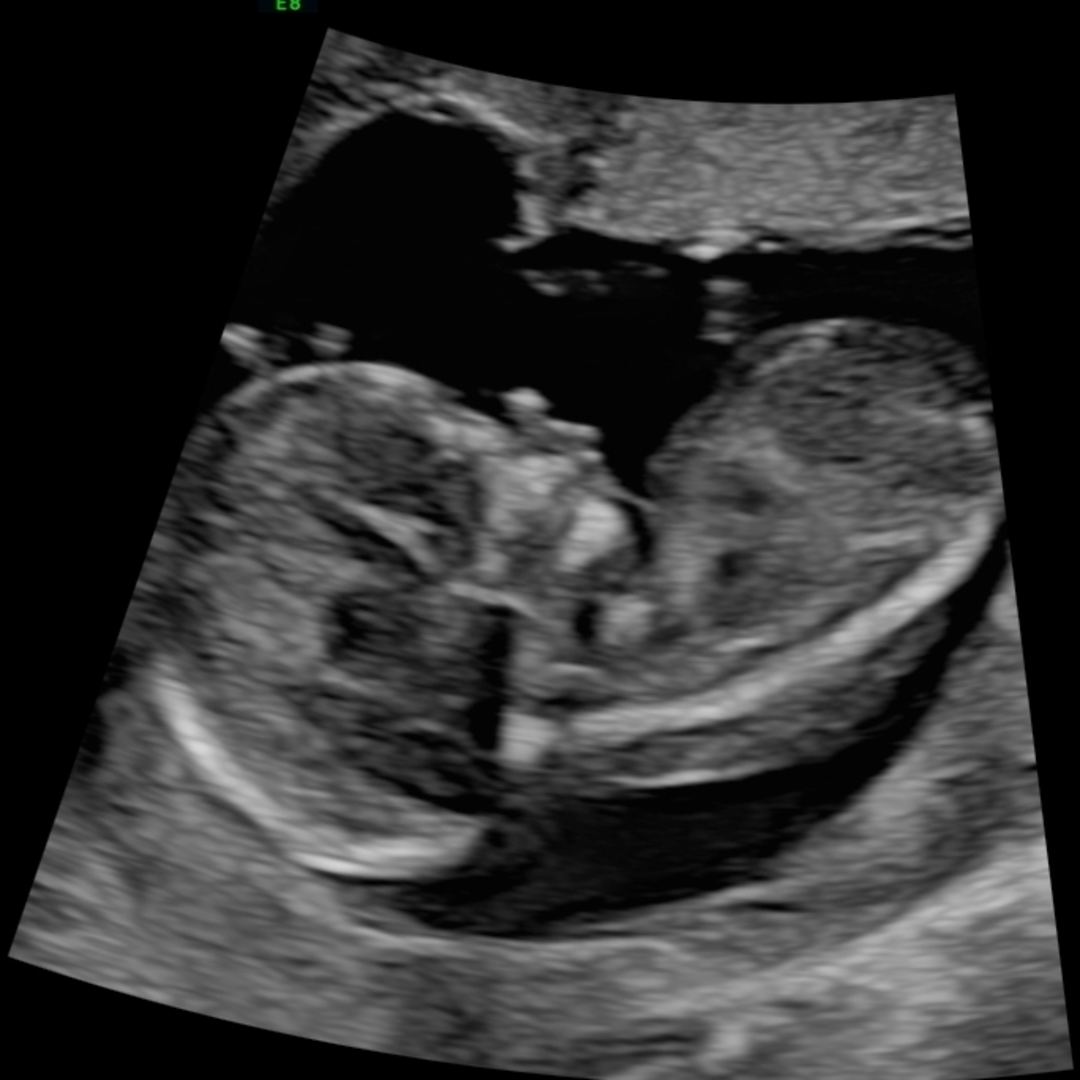 Photo shared by Daija for their Babylist baby registry.