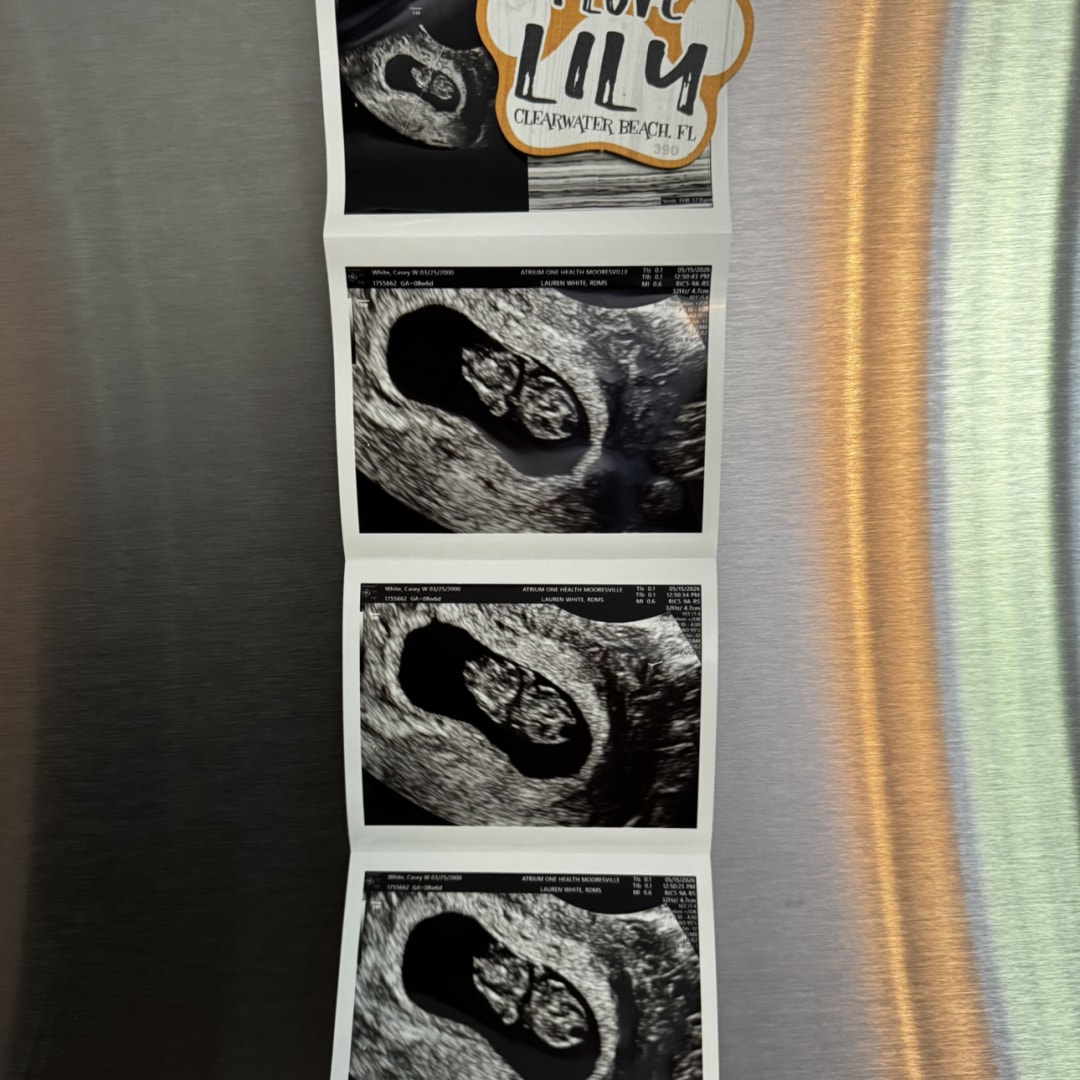 Photo shared by Casey for their Babylist baby registry.