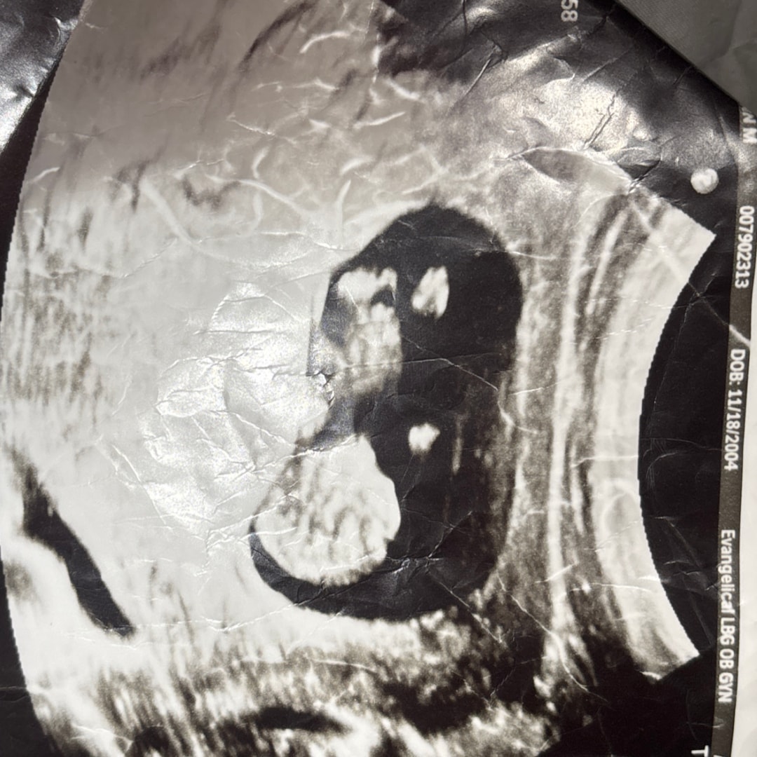 Photo shared by Kilynn for their Babylist baby registry.