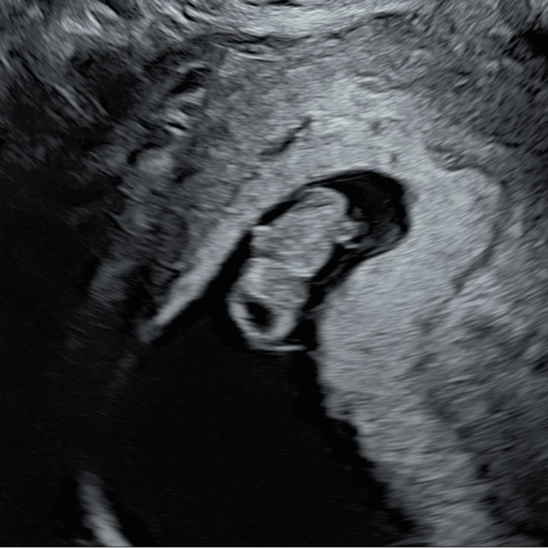 Photo shared by Madison for their Babylist baby registry.