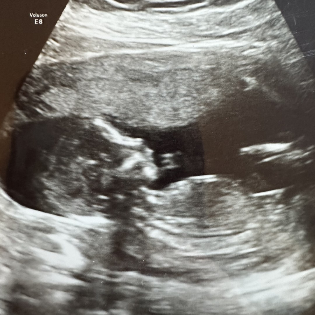 Photo shared by Jasmine for their Babylist baby registry.