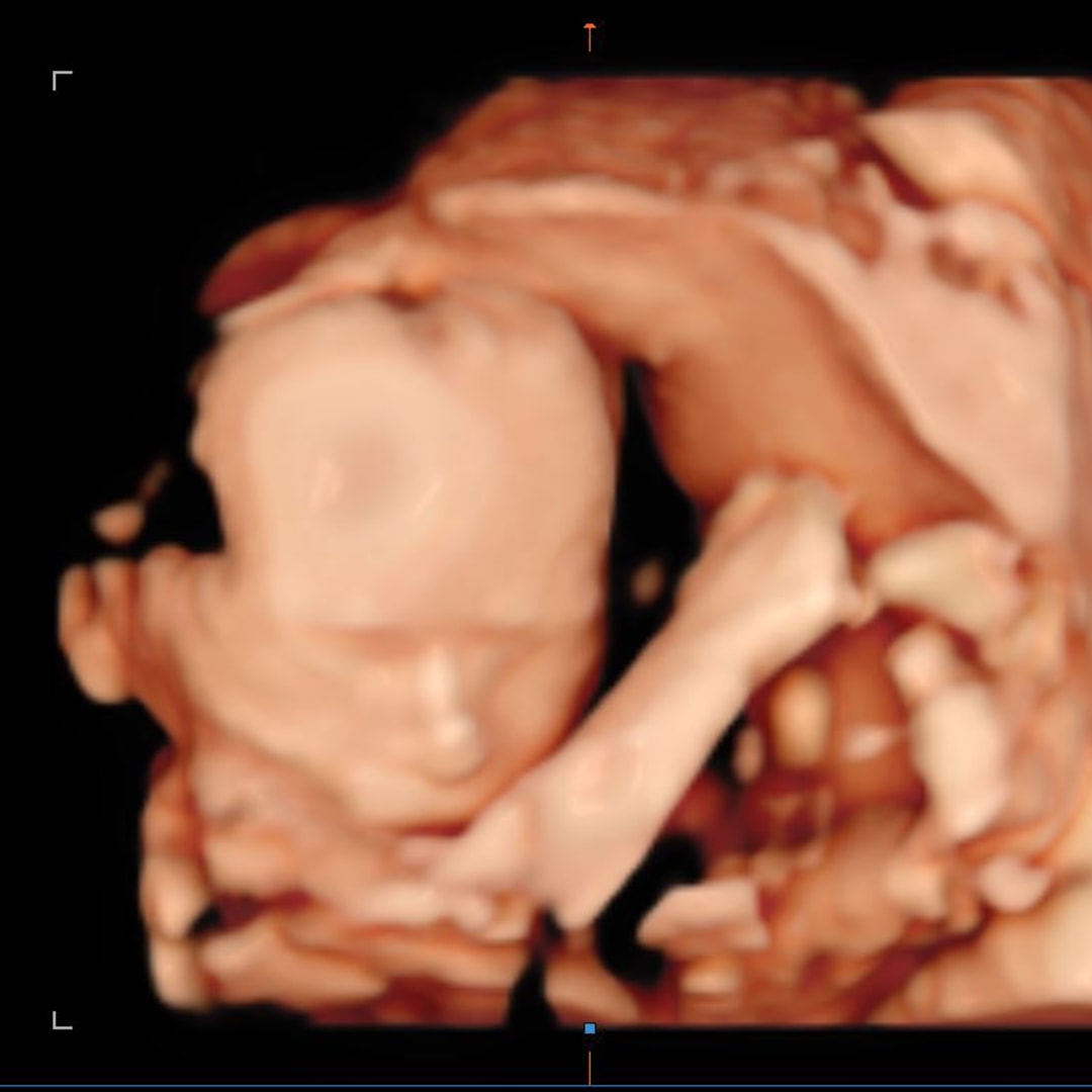 Photo shared by Christina for their Babylist baby registry.