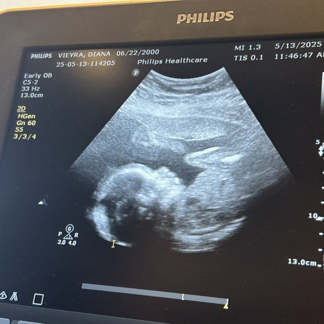 Photo shared by Diana for their Babylist baby registry.