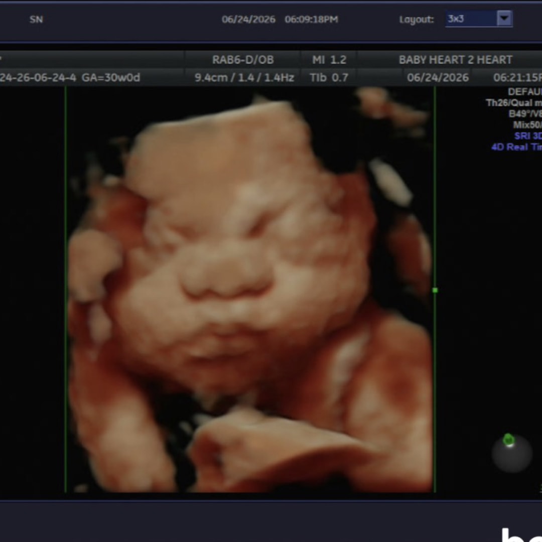 Photo shared by Sydney for their Babylist baby registry.