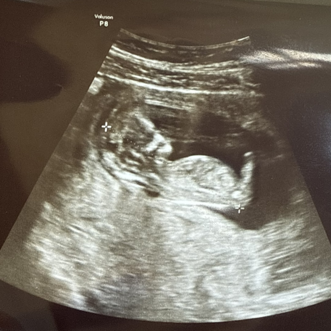 Photo shared by Morgan for their Babylist baby registry.