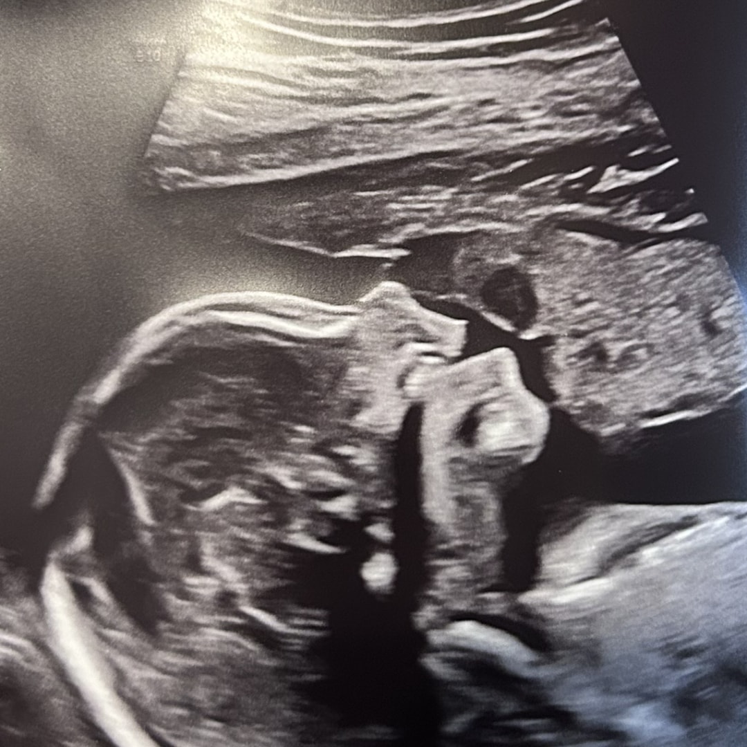 Photo shared by Elise for their Babylist baby registry.