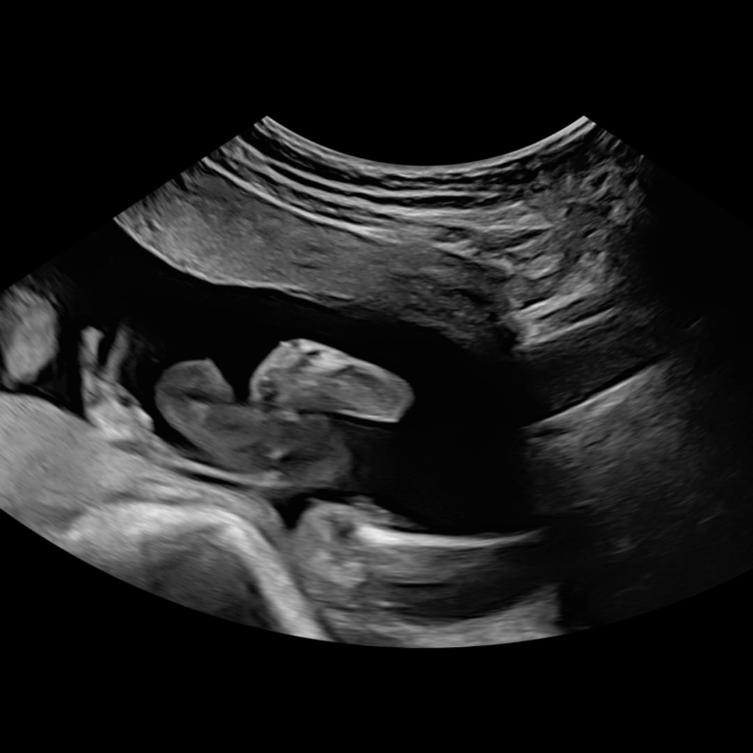 Photo shared by Gianna for their Babylist baby registry.